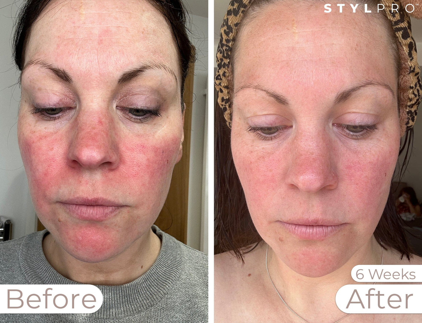 LED Professional Bundle